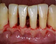 periodoncia2