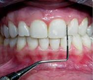 periodoncia3
